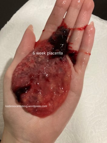 Selah 6w1d placenta wm